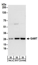 GAMT Polyclonal Antibody