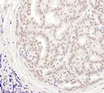 MEPCE Polyclonal Antibody