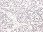 MEPCE Polyclonal Antibody