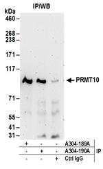 PRMT10 Antibody in Immunoprecipitation (IP)