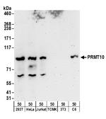 PRMT10 Polyclonal Antibody