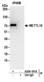 METTL16 Polyclonal Antibody