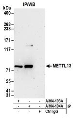 METTL13 Antibody in Immunoprecipitation (IP)