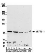 METTL13 Polyclonal Antibody