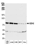 EZH2 Polyclonal Antibody