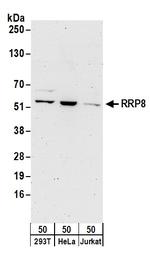 RRP8 Polyclonal Antibody