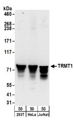 TRMT1 Polyclonal Antibody