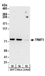 TRMT1 Polyclonal Antibody