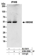HMGN5 Antibody in Immunoprecipitation (IP)