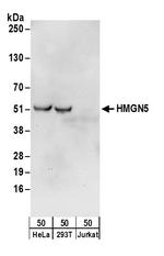HMGN5 Polyclonal Antibody