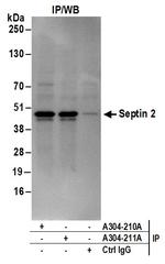 Septin 2 Antibody in Immunoprecipitation (IP)