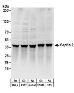 Septin 2 Polyclonal Antibody