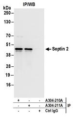 Septin 2 Antibody in Immunoprecipitation (IP)