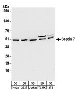 Septin 7 Polyclonal Antibody