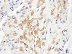 Septin 7 Polyclonal Antibody