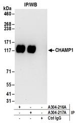 CHAMP1 Antibody in Immunoprecipitation (IP)