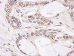 CHAMP1 Polyclonal Antibody