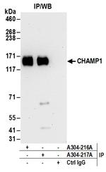 CHAMP1 Antibody in Immunoprecipitation (IP)