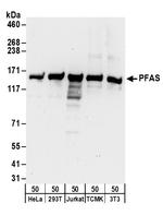 PFAS Polyclonal Antibody