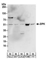ZIPK Polyclonal Antibody