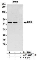 ZIPK Polyclonal Antibody