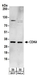 CDK4 Antibody in Western Blot (WB)