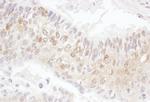 CDK4 Antibody in Immunohistochemistry (Paraffin) (IHC (P))