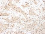 CDK4 Antibody in Immunohistochemistry (Paraffin) (IHC (P))