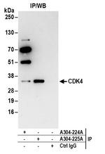 CDK4 Antibody in Immunoprecipitation (IP)