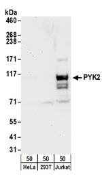 PYK2 Polyclonal Antibody
