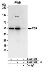 CSK Antibody in Immunoprecipitation (IP)