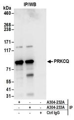 PRKCQ Antibody in Immunoprecipitation (IP)