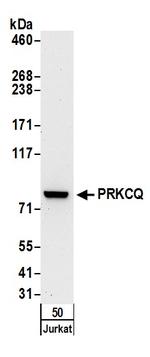 PRKCQ Polyclonal Antibody