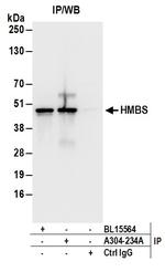 HMBS Antibody in Immunoprecipitation (IP)