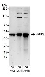 HMBS Polyclonal Antibody