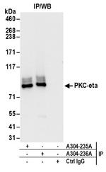 PKC-eta Polyclonal Antibody