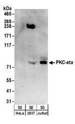PKC-eta Polyclonal Antibody