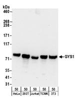GYS1 Polyclonal Antibody