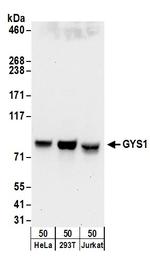 GYS1 Polyclonal Antibody