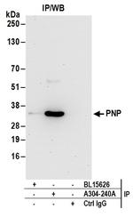 PNP Antibody in Immunoprecipitation (IP)