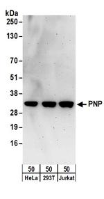 PNP Polyclonal Antibody