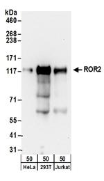 ROR2 Polyclonal Antibody
