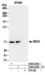 RSK3 Antibody in Immunoprecipitation (IP)