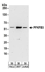 PFKFB3 Polyclonal Antibody