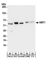 NMT1 Polyclonal Antibody