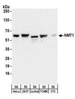 NMT1 Polyclonal Antibody
