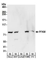 PFKM Polyclonal Antibody