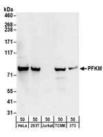 PFKM Polyclonal Antibody