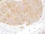 SHMT1 Antibody in Immunohistochemistry (Paraffin) (IHC (P))