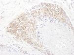 SHMT1 Polyclonal Antibody